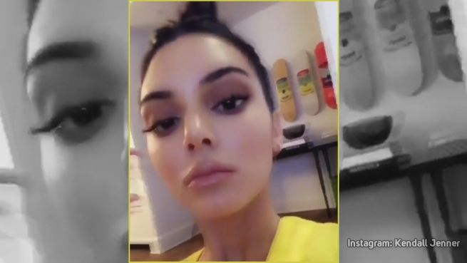 go to Künstlich gemacht? Kendall Jenner feuert zurück